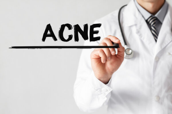 Here’s How to Choose the Best Acne Treatment in Montgomery County for Your Teen